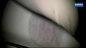 Vidéo 1 de présentation et préparation au TP d'endodontie