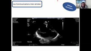 CIA et FOP diagnostic et guidage fermeture - Dr CASALTA.mp4