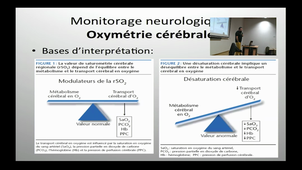 Perspectives en techniques de monitorage en médecine d'urgence
