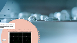Article 6 apoptose