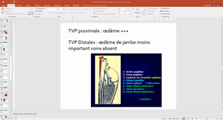 02-11-2020-PEREZ MARTIN- Systeme cardio vasculaire atelier 4 et 5