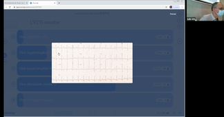 DFASM2 MIF 09/02/2021	14:00	16:00	Hypertension artérielle pulmonaire de l'adulte	FESLER P.	Salle 309	MIF