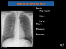 Radiographie du thorax