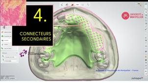 3SHAPE2025_PPAM MX 04 connecteurs secondaires.mp4
