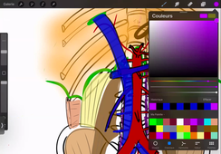 DFGSM2 UE : APPAREIL RÉNAL ET VOIES URINAIRES - 