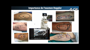 DU de Microchirurgie - Pr Herlin