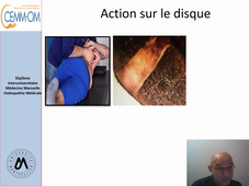 Manipulation vertébrale et mécanisme d'actions