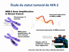 DU Lymphologie - Cancer du sein