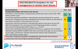 Echographie de stress -valvulopathies  - Pr HABIB.mp4