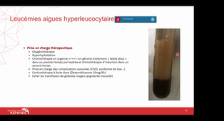 1- Classe virtuelle du 30/09/2022 - Urgences en hématologie (Dr Tony Marchand)