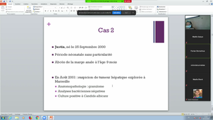 DFASM2 MIF (19/10/2020) Déficit immunitaire de l'enfant LOZANO C. - JEZIORSKI E.