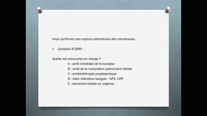 DFASM2 MIE - R RAYSSIGUIER 5/10/2020