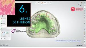 3SHAPE2025_PPAM MX 06 lignes de finition.mp4