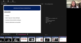Anomalies mitrales congénitales et anomalies coronaires_Dr VELLY.mp4