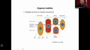 Radiothérapie des cancers digestifs_Dr MICHALET.mp4