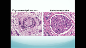 (21/10/2020) 14h-16h RABELAIS ED5 - Bases moléculaires et cellulaires des pathologies SZABLEWKI V