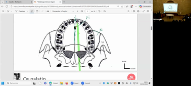 DFGSM2 UE Tête et cou - CM2 - Ostéologie et région face - Pr.Captier - 05/02/26