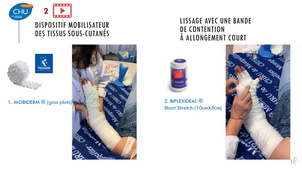 DU Lymphologie - Atelier bandage multi-composant du membre supérieur