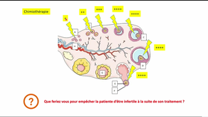 DFGSM-CM14-RFE-DR BROUILLET