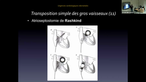 Urgences cardiologiques néo-natales - Dr RAUZIER