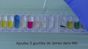 Lecture de la galerie API 20E