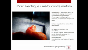 Mecanisme et mesure de prevention ‐ Réalisée avec Clipchamp.mp4