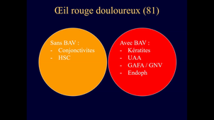 OPHTALMOLOGIE	Module 2	Mardi	10/01/2023	13:00	14:00	1 + 2	CHLOE CHAMARD	AMPHI RONDELET