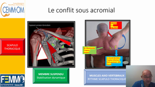 Congres FEMMO Ostéopathie médicale et conflit