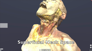 Neck dissection