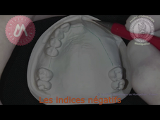 M1_tracé maxillaire_indices