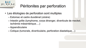 Douleur abdominale 1.mp4