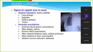 DFASM2 MIF - DE JONG A. (27/10/2020) 14h Insuffisance respiratoire aiguë