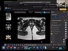 DFGSM2-Martin BERTRAND-App renal et voies urinaires -CM1 et CM5-18-02-2026.mp4