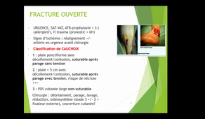 DFASM1 MIC BO 16/12/2020	16:00	17:00	BO		Best of orthopédie des membres inférieurs	Dr Camille Sleth	UPM 1