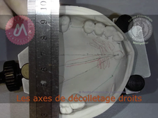 M6_tracé maxillaire_axes décolletage latéraux