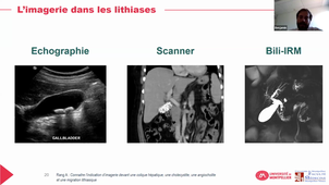 CM 10 - HGE_Benjamin RAUX_22_03_2024