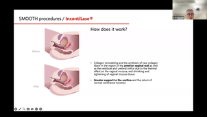 GMT20260317-072501_Recording_1920x1080.mp4