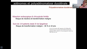 Tumeur du duodénum - Pr HARDWIGSEN.mp4