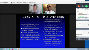 D.U Insuffisance Cardiaque Pr E FLECHER