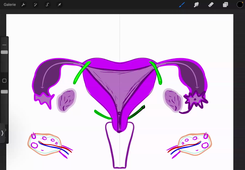CM 6 - Appareil voie urinaires - Organes génitaux masculins et féminins Dr Martha Duraes 10/03/2025