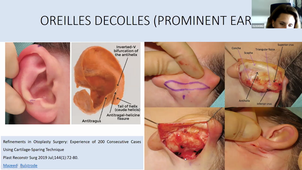 DU de chirurgie plastique pédiatrique Dr Maggiulli, Anomalies de l'oreille 08/04/2021