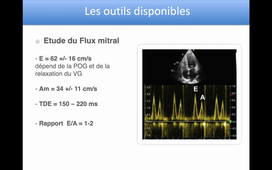 Fonction Diastolique du ventricule Gauche - Dr SOULLIER