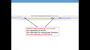 DU PATHOLOGIE DU MOUVEMENT CHEZ L'ENFANT - 01/04/2026