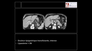 11/05/2021	14:00	15:30	Ateliers d'imagerie - imagerie digestive	BENOUDIFA Bachir	Amphi UPM	3622830573	DFASM3