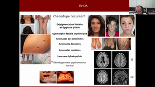 26012021j2-2-DIU Diagnostic de précision part 2