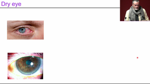 M2S1-Pr.Michon_Innovative therapies to treat cornet pathologies_22/11/2024