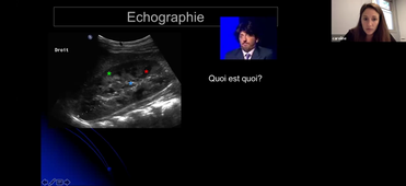 DFASM1 MIC 18/11/2020 Indications de l'imagerie en pathologie uro-néphro. Stratégie bénéfice risque (imagerie anatomie des structures)	Dr Jessica Delebecq	UPM 2