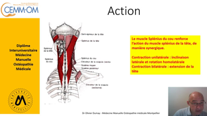 Techniques EPI  SPLENIUS CERVICIS CAPITIS