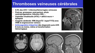 DFASM1 MID 08/01/2021	09:00	12:00	BEST OF + QR NEUROLOGIE	A-DUCROS	AMPHI ZIEGELMANN
