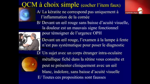 30/04/2021	08:00	09:30	oeil rouge et/ou douloureux - Glaucome -Paupières - SEP (102)	M-VILLAIN	ziegelman	https://umontpellier-fr.zoom.us/j/8057374180	mid